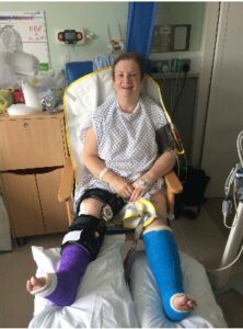 Wendy sitting in hospital with her legs in casts