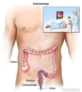 Colon diagram