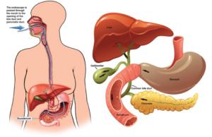 ERCP diagram