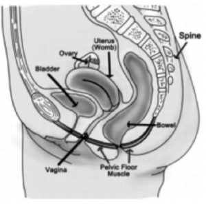 A diagram showing a person's bladder, ovary, uterus, vagina, pelvic floor muscle, bowel, and spine