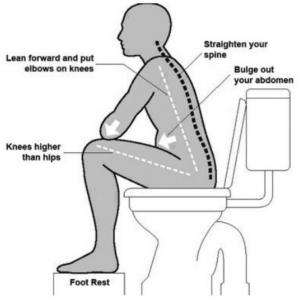 Diagram of a person sitting on the toilet, showing what it does to their spine and abdomen