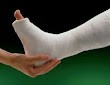 A foot in a cast being supported by the ankle by a persons hand