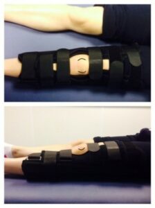 Knee brace worn by a patient