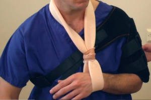 Middle arm break sling demonstration