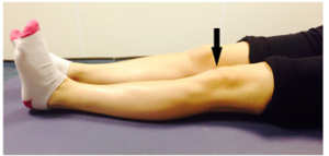 Static Quadriceps Exercise showing legs flat and an arrow pointing down towards the knee