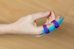 A blue and purple splint wrapped around a finger