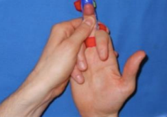 Bending the tip of an injured finger