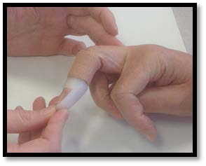 Demonstration of benging the middle joint of the finder while using the splint