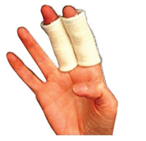 Example of a Bedford splint