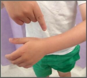 Pointing at the location of the distal radius below the wrist