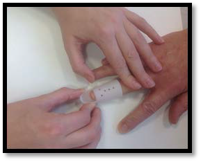 Removing old tape from the end of the finger splint