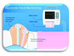 Electronic fetal monitoring diagram
