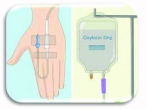 Oxytocin drip illustration
