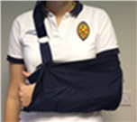 Person wearing a sling to support their arm